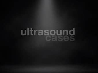 TV ultrasound Archives • LITFL