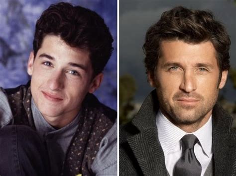 Patrick Dempsey Before and After Plastic Surgery