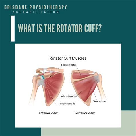 What is the Rotator Cuff? - Brisbane Physiotherapy