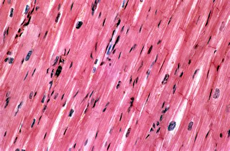 Light micrograph of cardiac muscle - Stock Image - P154/0063 - Science ...