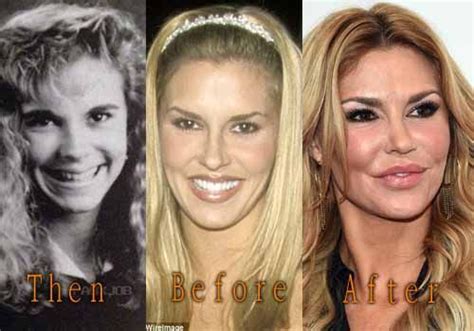 Brandi Glanville - oh my...too much plastic surgery on her face. Not good! | Celebrity surgery ...