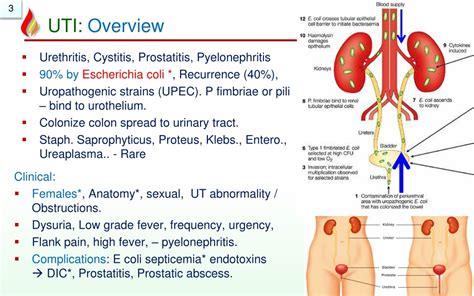 Pathophysiology Urinary Tract Infections Ppt - vrogue.co