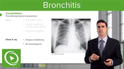 How to get rid of acute bronchitis fast - Acute bronchitis treatment