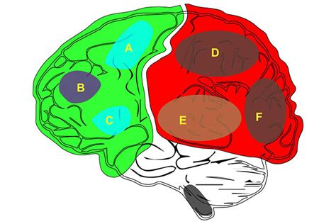 New Techniques Reveal Neural Correlates of Consciousness – InfoMed Coverage- Driven for MedTech ...