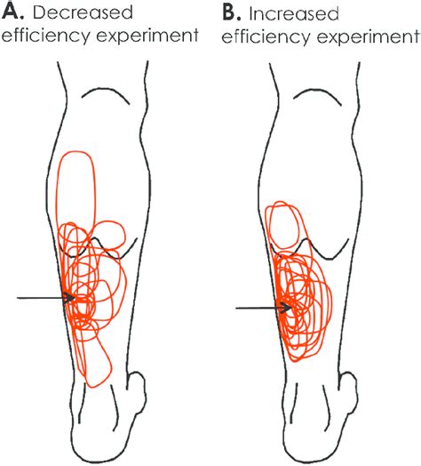 Area of perceived pain for each experiment. The injection site (arrow)... | Download Scientific ...