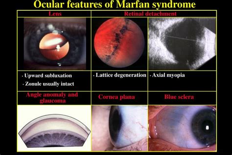 PPT - ECTOPIA LENTIS PowerPoint Presentation - ID:6747605