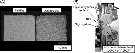 (A) Picture of the polyurethane foam blocks replicating healthy and... | Download Scientific Diagram