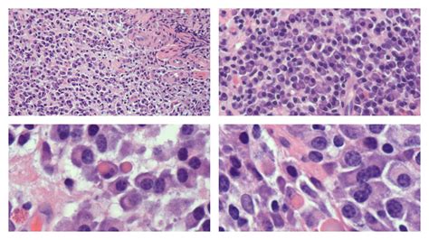 Histology, Plasma Cells Article - StatPearls