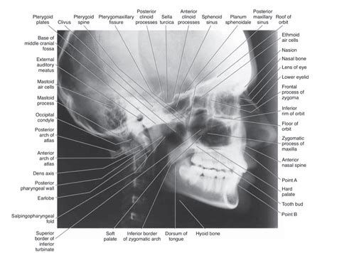 Lateral Cephalogram x-ray | News | Dentagama