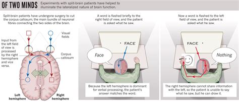 Split Brain Patterns – Intro Psych Blog (F19)_Group 5