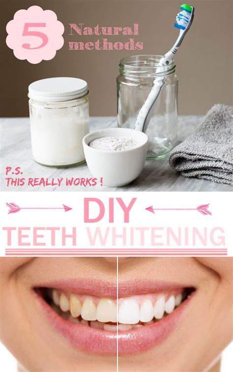 5 Natural Teeth Whitening Methods - HomeMadeLifeProject