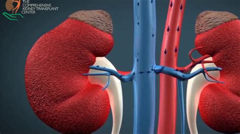 Kidney Transplant Surgery Explained - YouTube