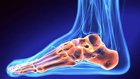 Avulsion Fracture of the Ankle: Symptoms, Causes, Treatment & Recovery