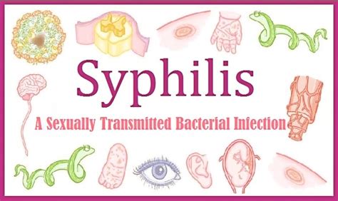 Syphilis - A Sexually Transmitted Bacterial Infection: Types and Stages