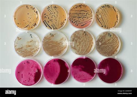 Selective media Agar Plates With bacteria colonies in various petri dish Stock Photo - Alamy