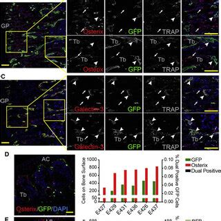 Some Endo-cortical-Associated Donor Cells Are F4/80+ Osteal Macrophages | Download Scientific ...