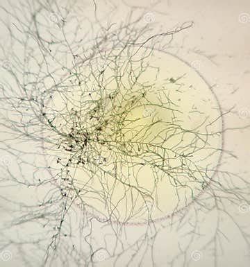 Fungi and Bacteria Under the Microscope Stock Photo - Image of biology, saboraud: 177852482