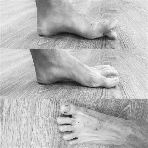 How To Treat Foot Pain With Easy Foot Strengthening Exercises — Evolve ...