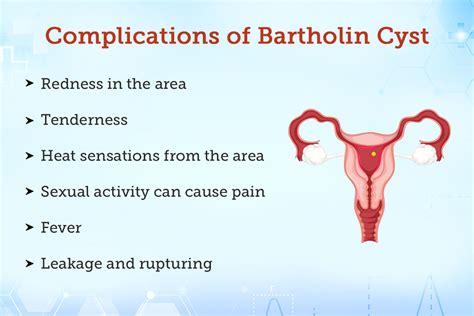 Bartholin Abscess: Treatment, Procedure, Cost, Recovery, Side Effects And More