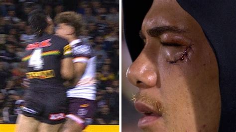 Reece Walsh face injury leaves NRL icon stunned over Taylan May referee ...