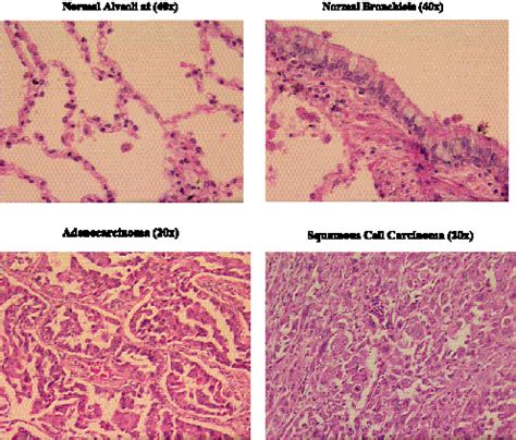 Histology of normal and tumor tissues used in this study. | Download Scientific Diagram