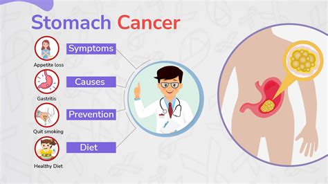 What is stomach cancer? | Symptoms, Causes, Diet - Body Revival