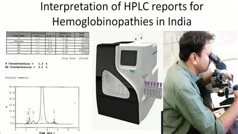 Interpretation of HPLC reports for Hemoglobinopathies - YouTube