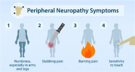 Homeopathy for Neuropathy