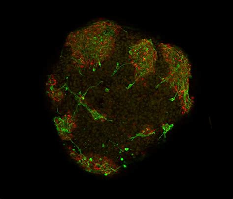 Neurone development, embryoid body | Wellcome Collection