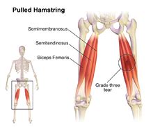 Hamstring - Wikipedia