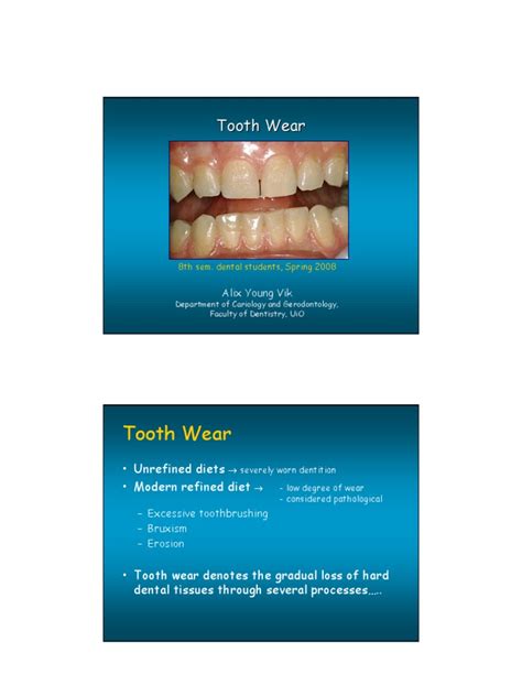 Tooth Wear | Tooth Enamel | Dentistry