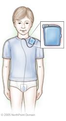 Treatments - Nocturnal Enuresis Therapies - Dr. Perlow Urology