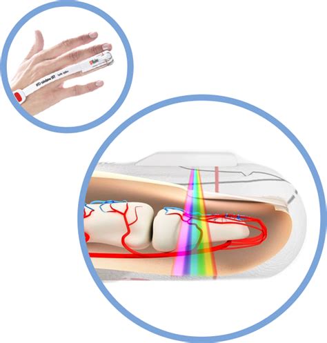 Masimo rainbow SET™ enhance Phillips lntelliVue patient monitors | Philips Healthcare