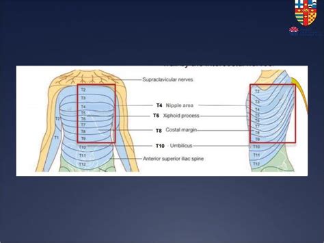 Serratus Anterior Plane Block