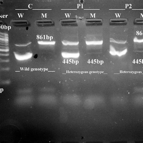 Beta globin gene cluster on chromosome 11 showing all five beta globin ...