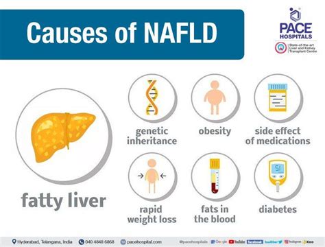 NAFLD & NASH - Symptoms, Causes, Differences & Treatment Options