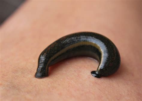 Benefits of Medicinal Leeches | Leeches Therapy | Hirudotherapy FAQ