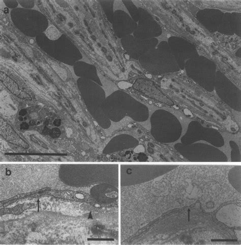 (Patient 1) Electron micrographs of the trabecular meshwork. (a) The... | Download Scientific ...