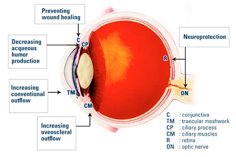 gene therapy for glaucoma | new-glaucoma-treatments.com