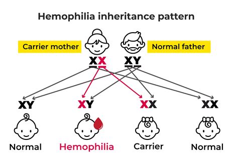 Hemophilia - Inheritance Patterns, Diagnosis, and Medication Options.