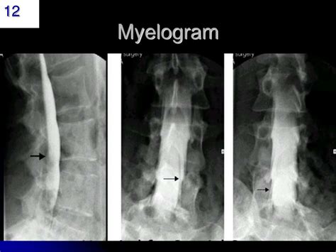 PPT - Radiographic Contrast Media PowerPoint Presentation, free download - ID:1254367