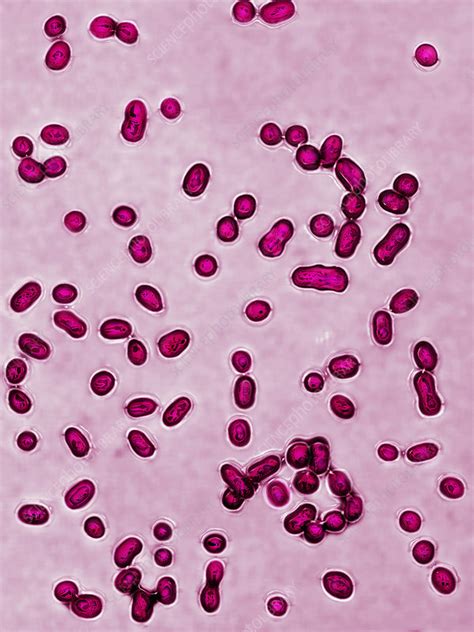 Streptococcus pneumoniae bacteria, LM - Stock Image - C028/2787 - Science Photo Library