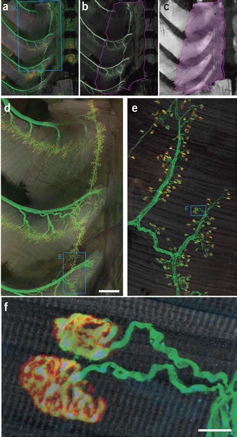 Innervation pattern of the triangularis sterni muscle.(a–c ...