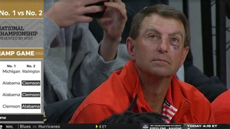 Dabo Swinney goes viral for attending Clemson game with black eye