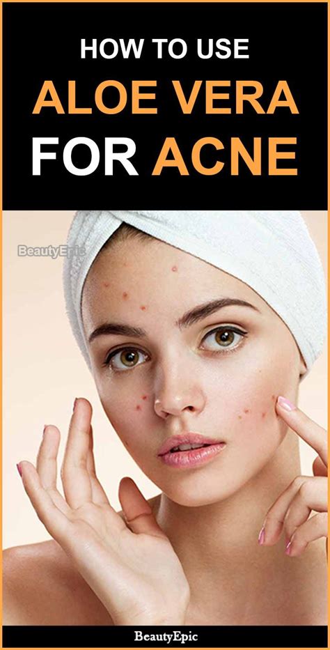 How To Use Aloe Vera For Acne? | Skin care routine, Acne, Skin care secrets