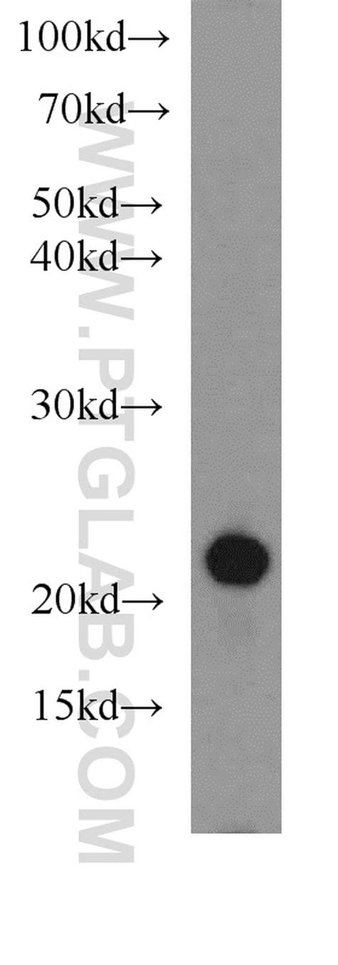 CD3 Antibody (17617-1-AP)