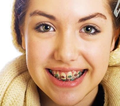 How to Take Care of Your Braces and Get 11 Braces Care Tips Now | How ...