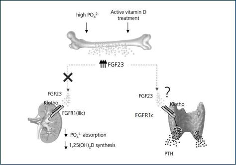 FGF23: a key player in mineral and bone disorder in CKD | Nefrología