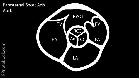 Parasternal Short-Axis Echocardiogram View