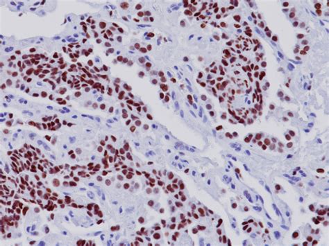 TTF-1 Antibody - Biocare Medical